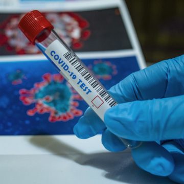 Albania to Start COVID-19 Rapid Antigen Testing on Monday