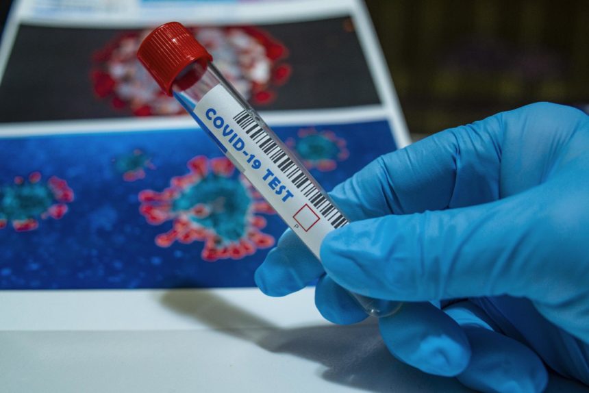 Albania to Start COVID-19 Rapid Antigen Testing on Monday